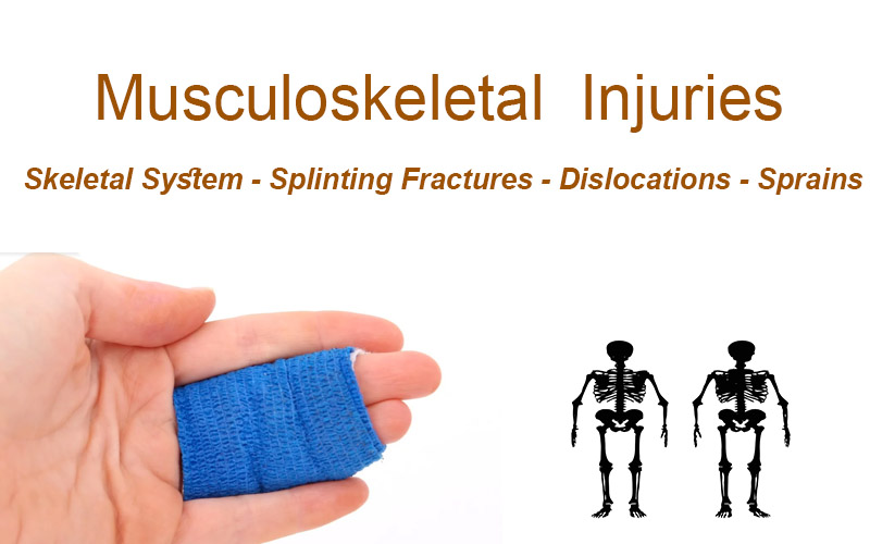 Musculoskeletal Injuries - Splinting Fractures - Dislocations - Sprains